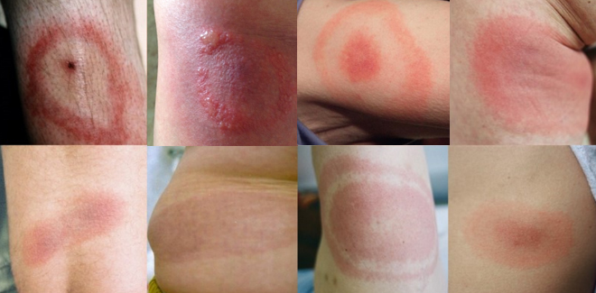 rumień wędrujący jak wygląda